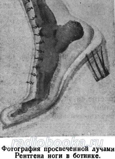 Фотография просвеченной лучами Рентгена ноги в ботинке